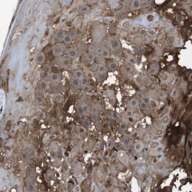 Anti-CDH20 antibody produced in rabbit
