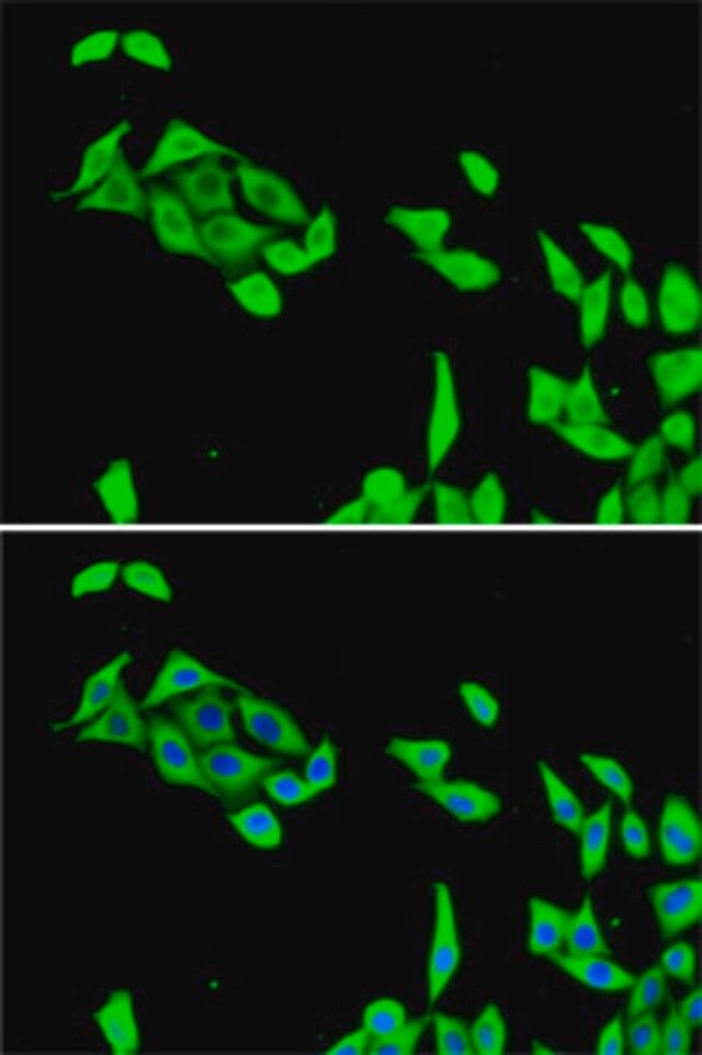 Anti-CDK5 antibody produced in rabbit