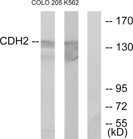 Anti-CDH2 antibody produced in rabbit