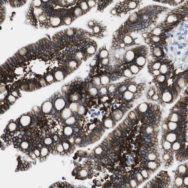 Anti-CDH8 antibody produced in rabbit