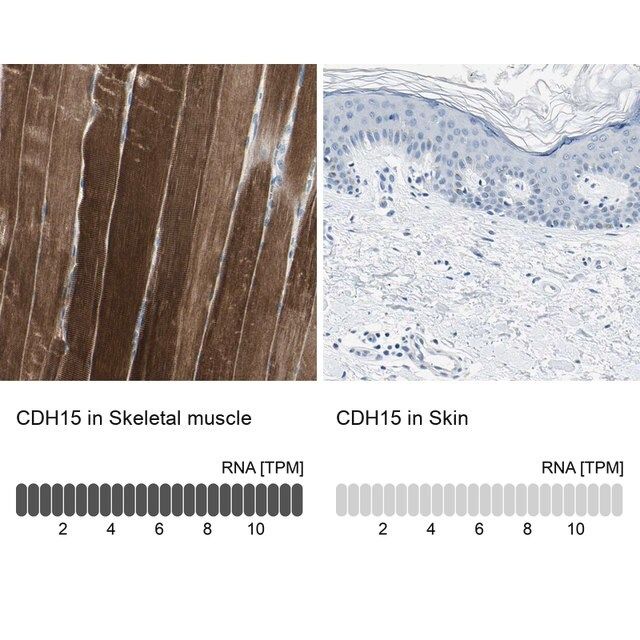 Anti-CDH15 antibody produced in rabbit