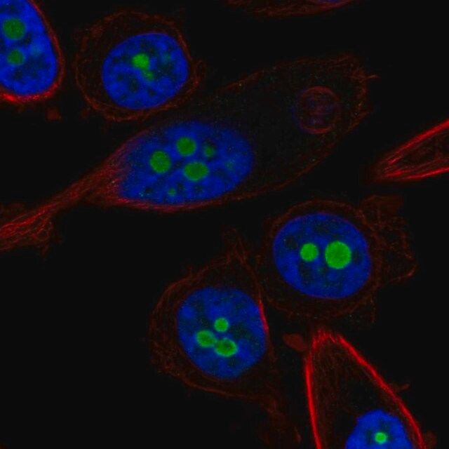 Anti-CDKN2A antibody produced in rabbit