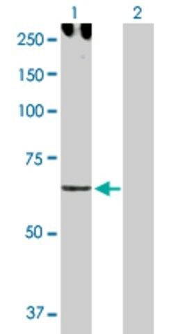 Anti-CDH6 antibody produced in rabbit