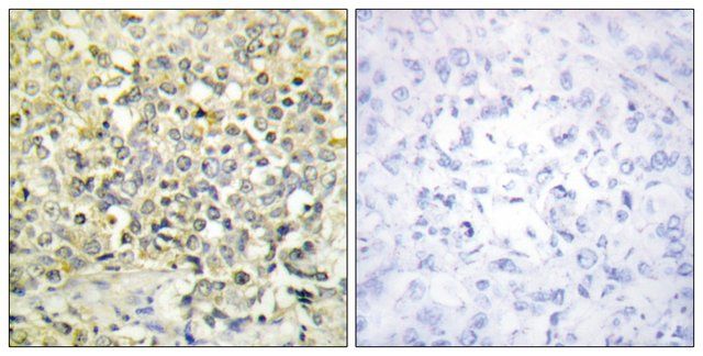 Anti-CDKL4 antibody produced in rabbit