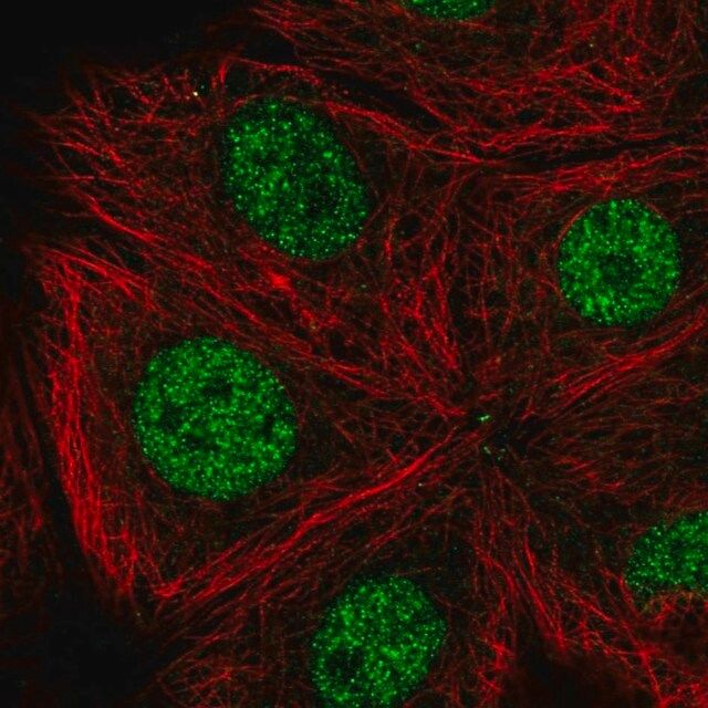 Anti-CDK10 antibody produced in rabbit