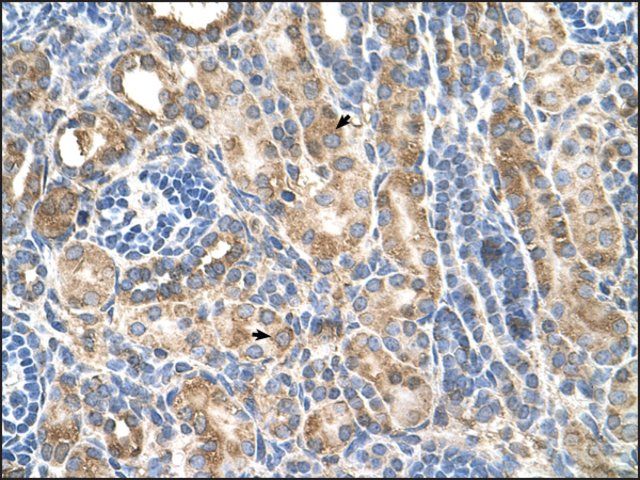 Anti-CDH3 antibody produced in rabbit