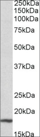 Anti-Cdkn2a antibody produced in goat