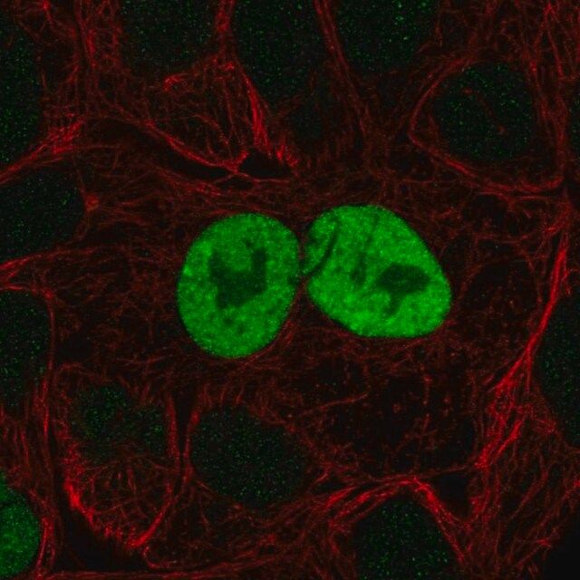 Anti-CDKN1A antibody produced in rabbit