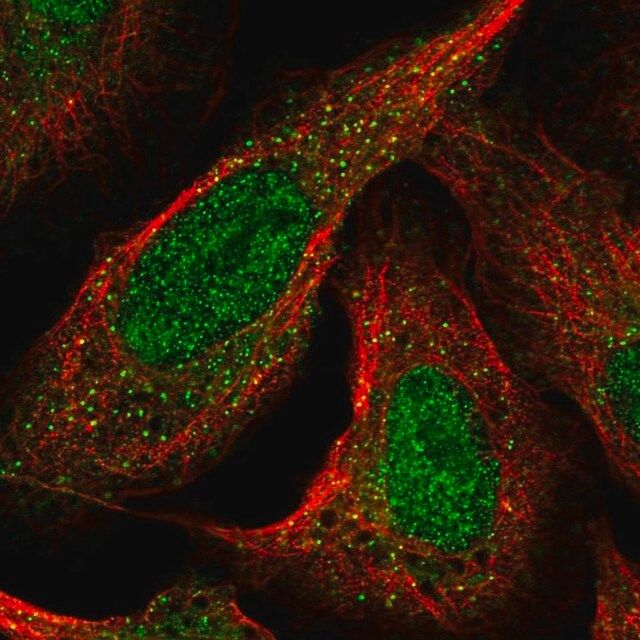 Anti-CDKL1 antibody produced in rabbit