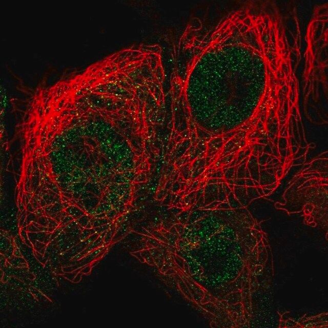 Anti-CDKN2D antibody produced in rabbit