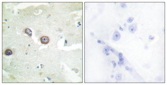 Anti-CDH4 antibody produced in rabbit