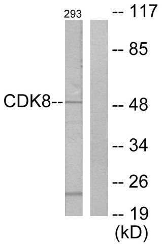 Anti-CDK8 antibody produced in rabbit