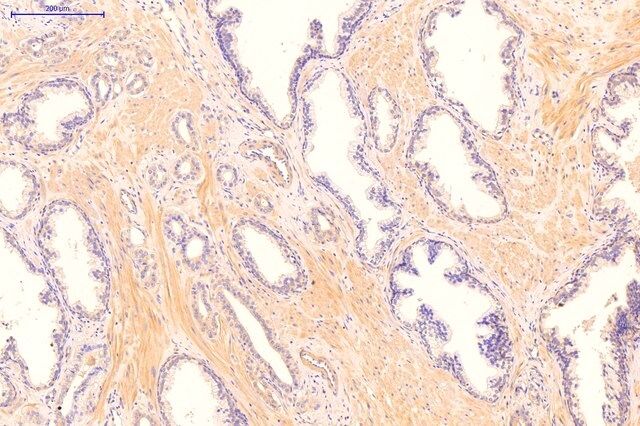 Anti-CDKN1A (N-terminal) antibody produced in rabbit