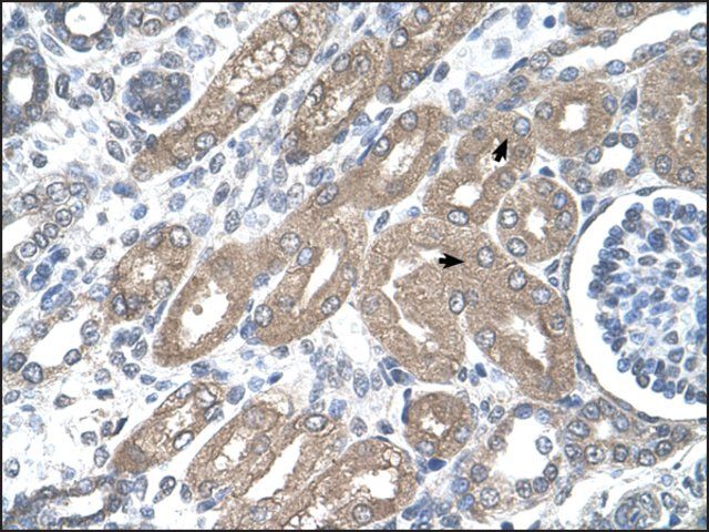 Anti-CDH8 antibody produced in rabbit
