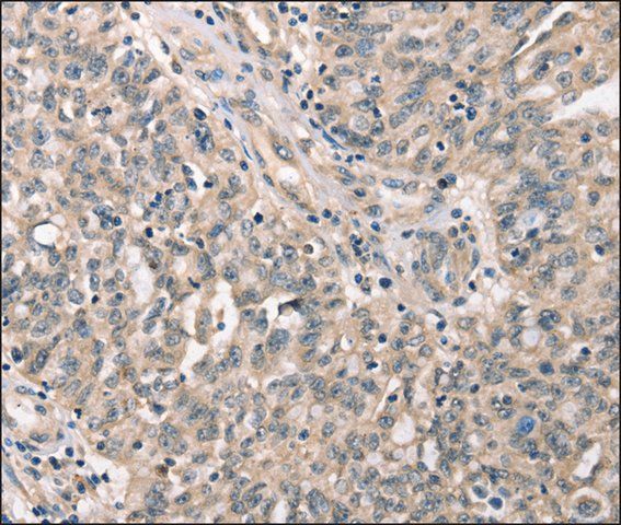ANTI-CDK12 antibody produced in rabbit