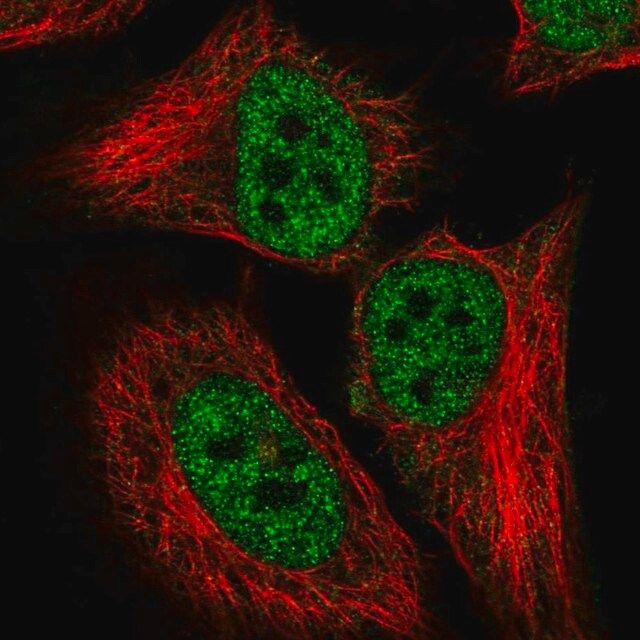 Anti-CDKN2AIP antibody produced in rabbit