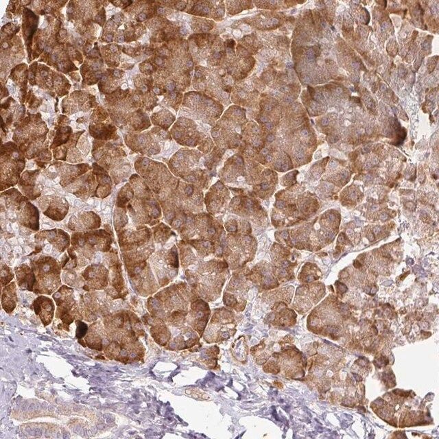 Anti-CCDC144A antibody produced in rabbit
