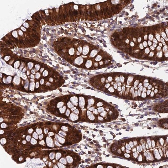 Anti-CCDC15 antibody produced in rabbit