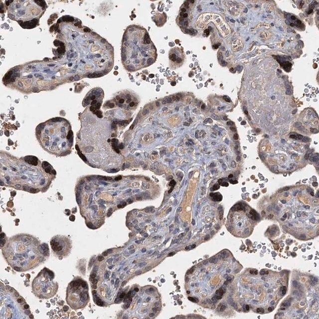 Anti-CCDC61 antibody produced in rabbit