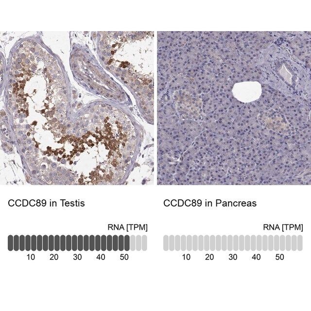 Anti-CCDC89 antibody produced in rabbit