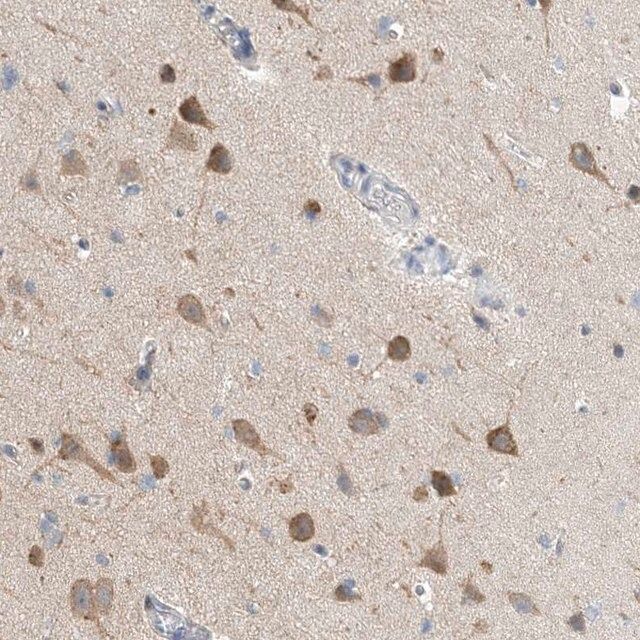 Anti-CCDC14 antibody produced in rabbit