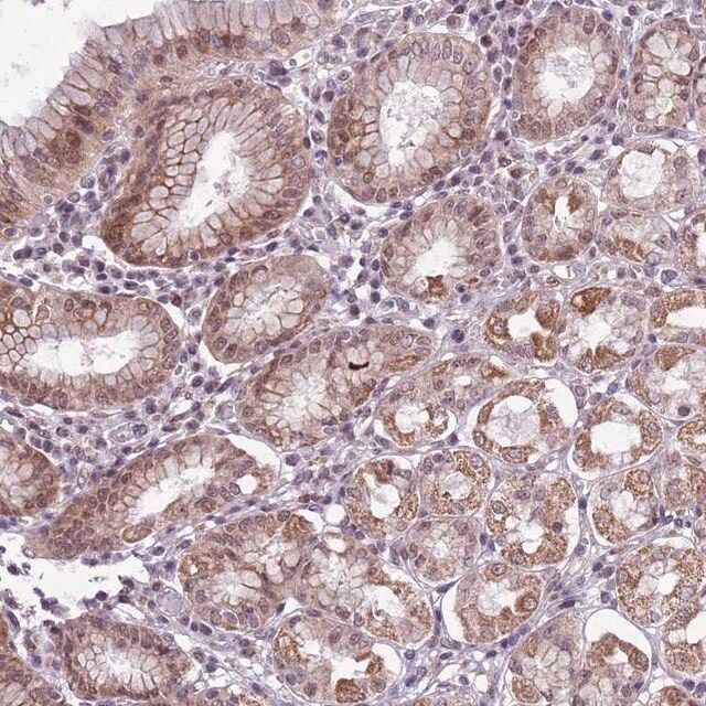Anti-CCDC166 antibody produced in rabbit