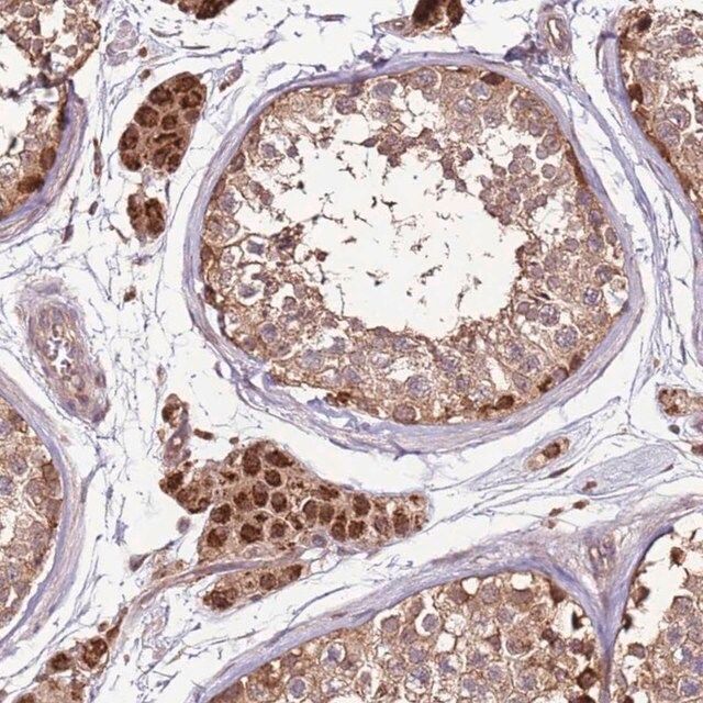 Anti-CCDC112 antibody produced in rabbit