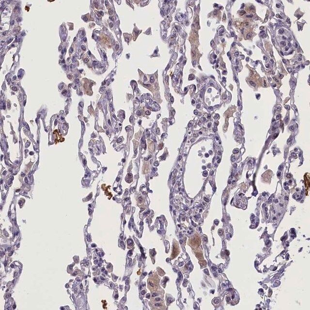 Anti-CCL23 antibody produced in rabbit