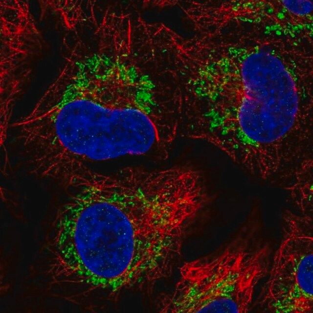 Anti-CCR7 antibody produced in rabbit