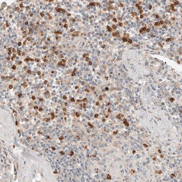 Anti-CCDC171 antibody produced in rabbit
