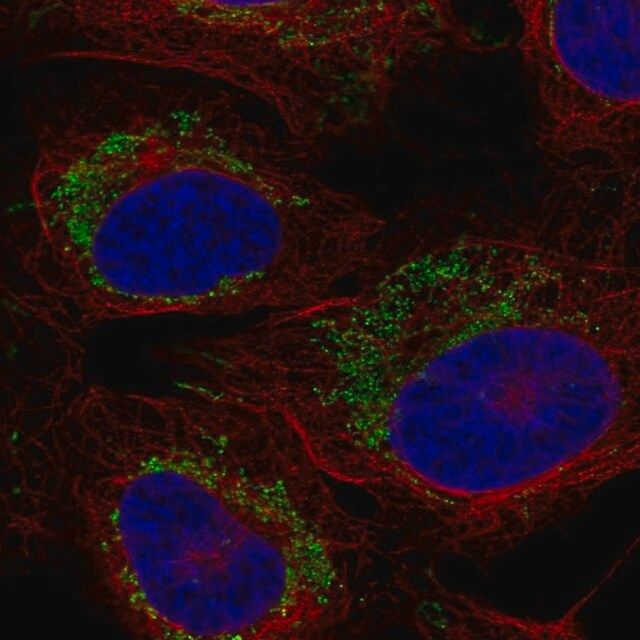 Anti-CCR7 antibody produced in rabbit