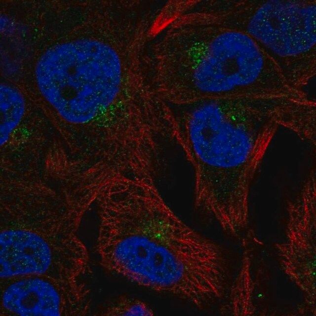 Anti-CCPG1 antibody produced in rabbit