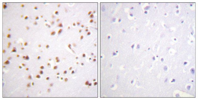 Anti-Catenin-δ1 antibody produced in rabbit