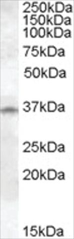 Anti-Cathepsin K antibody produced in goat