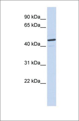 Anti-CATSPER2 antibody produced in rabbit