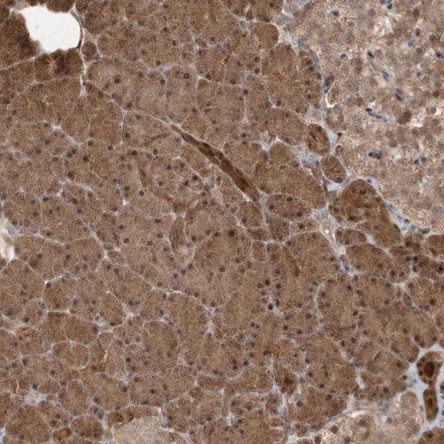 Anti-CATSPERB antibody produced in rabbit