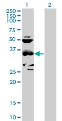 Anti-CCBL1 antibody produced in mouse