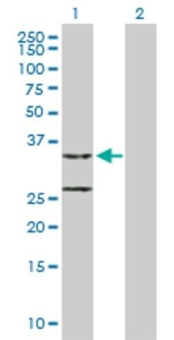 Anti-CCDC44 antibody produced in mouse