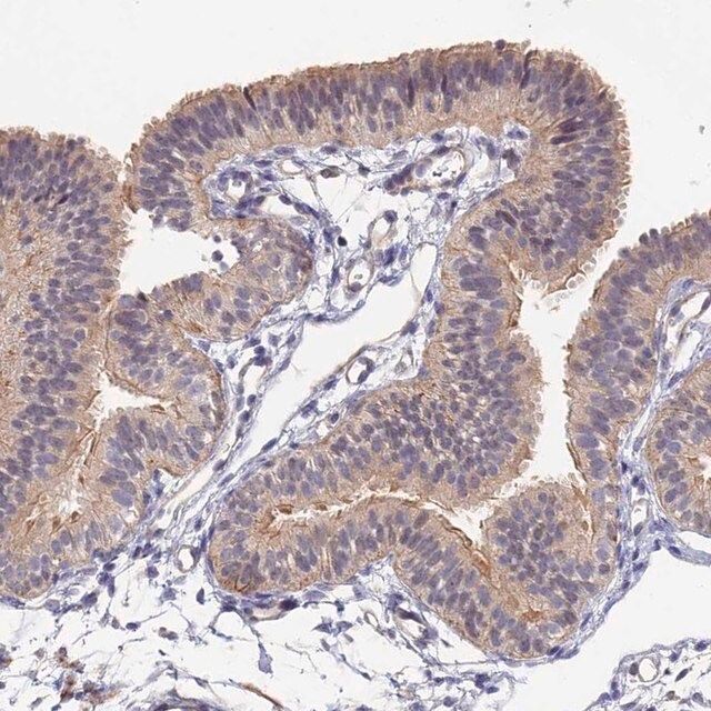 Anti-CCDC113 antibody produced in rabbit