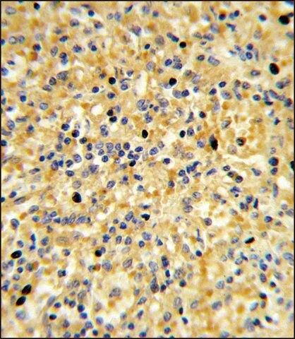 ANTI-CCDC3 (C-TERM) antibody produced in rabbit