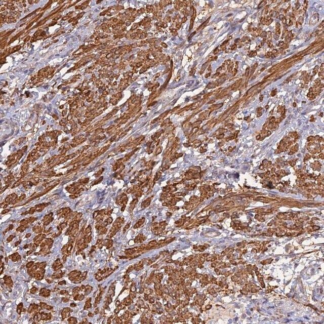 Anti-CCDC154 antibody produced in rabbit