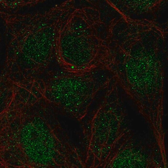 Anti-CCDC63 antibody produced in rabbit