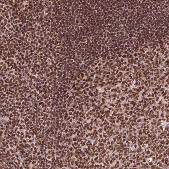 Anti-CCAR1 antibody produced in rabbit