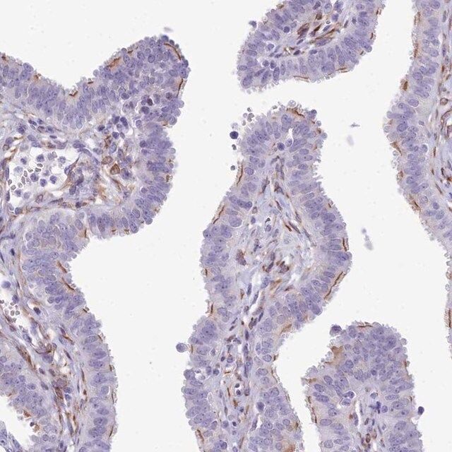 Anti-CC2D2A antibody produced in rabbit