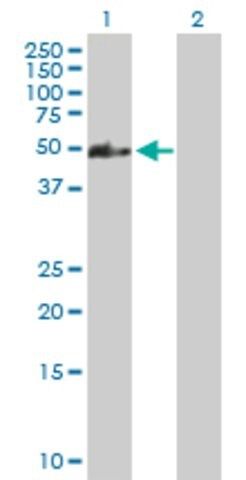 Anti-CCDC83 antibody produced in mouse