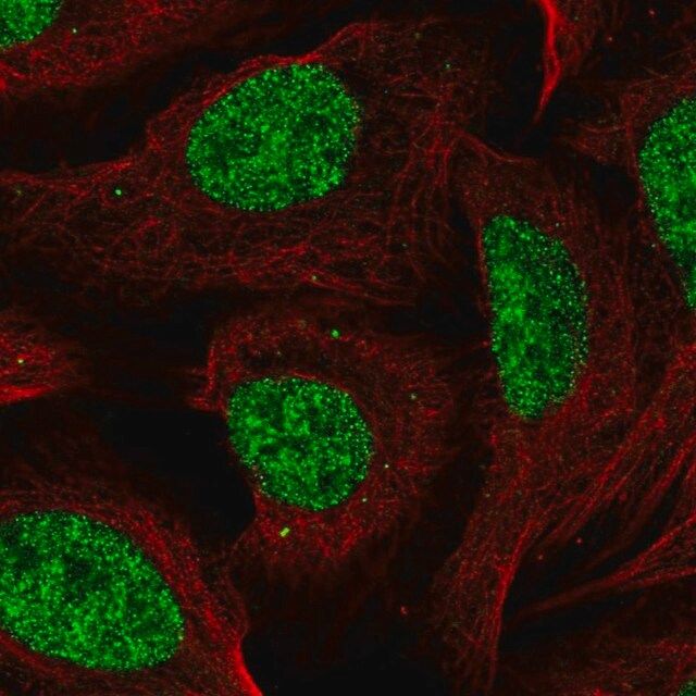 Anti-CCDC12 antibody produced in rabbit