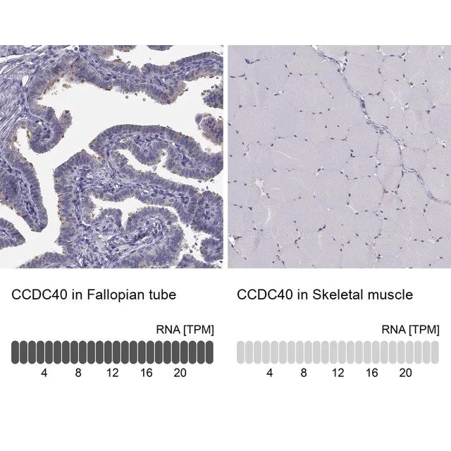 Anti-CCDC40 antibody produced in rabbit