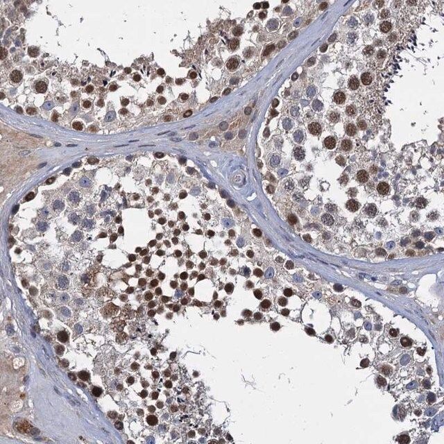 Anti-CCDC184 antibody produced in rabbit
