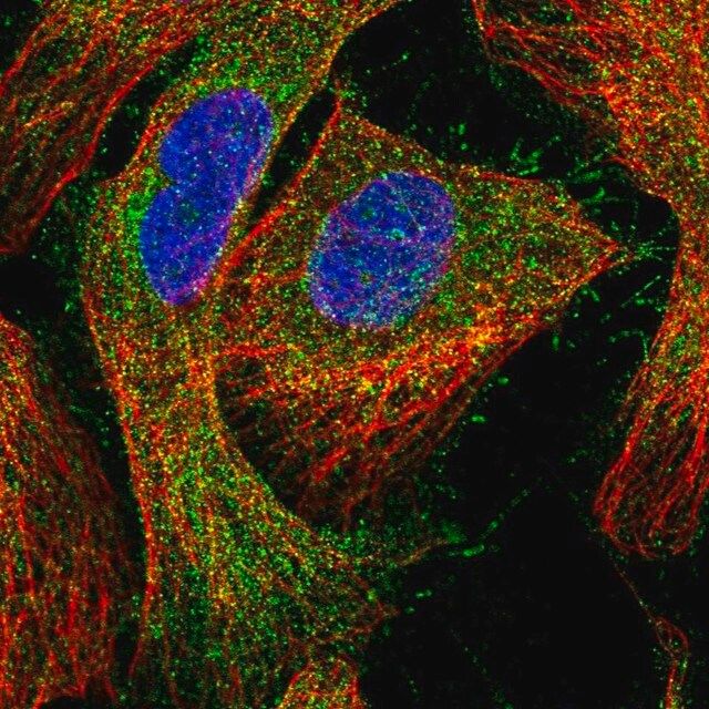 Anti-CCDC24 antibody produced in rabbit