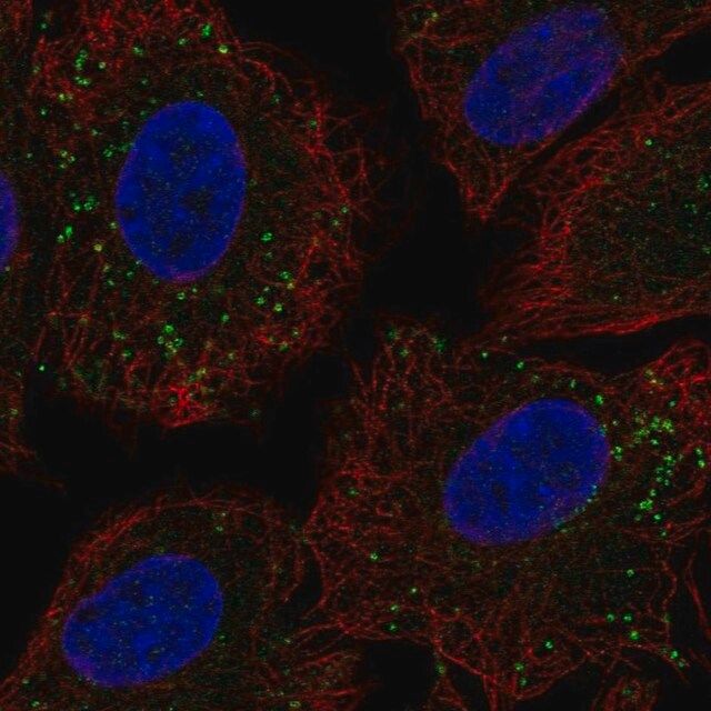 Anti-CCDC65 antibody produced in rabbit